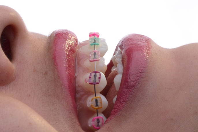 Ejemplo de Imagen informativa 3