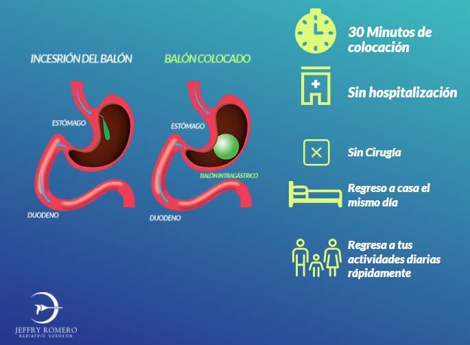 Ejemplo de Imagen informativa 2