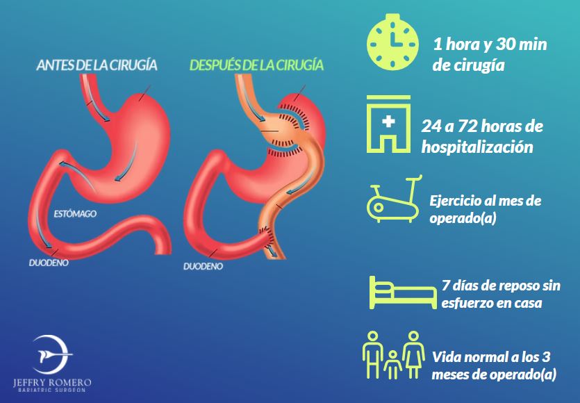 Ejemplo de Imagen informativa 3