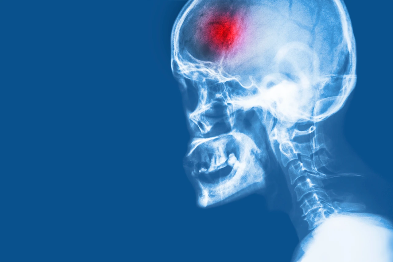 Ejemplo de Imagen Aqui