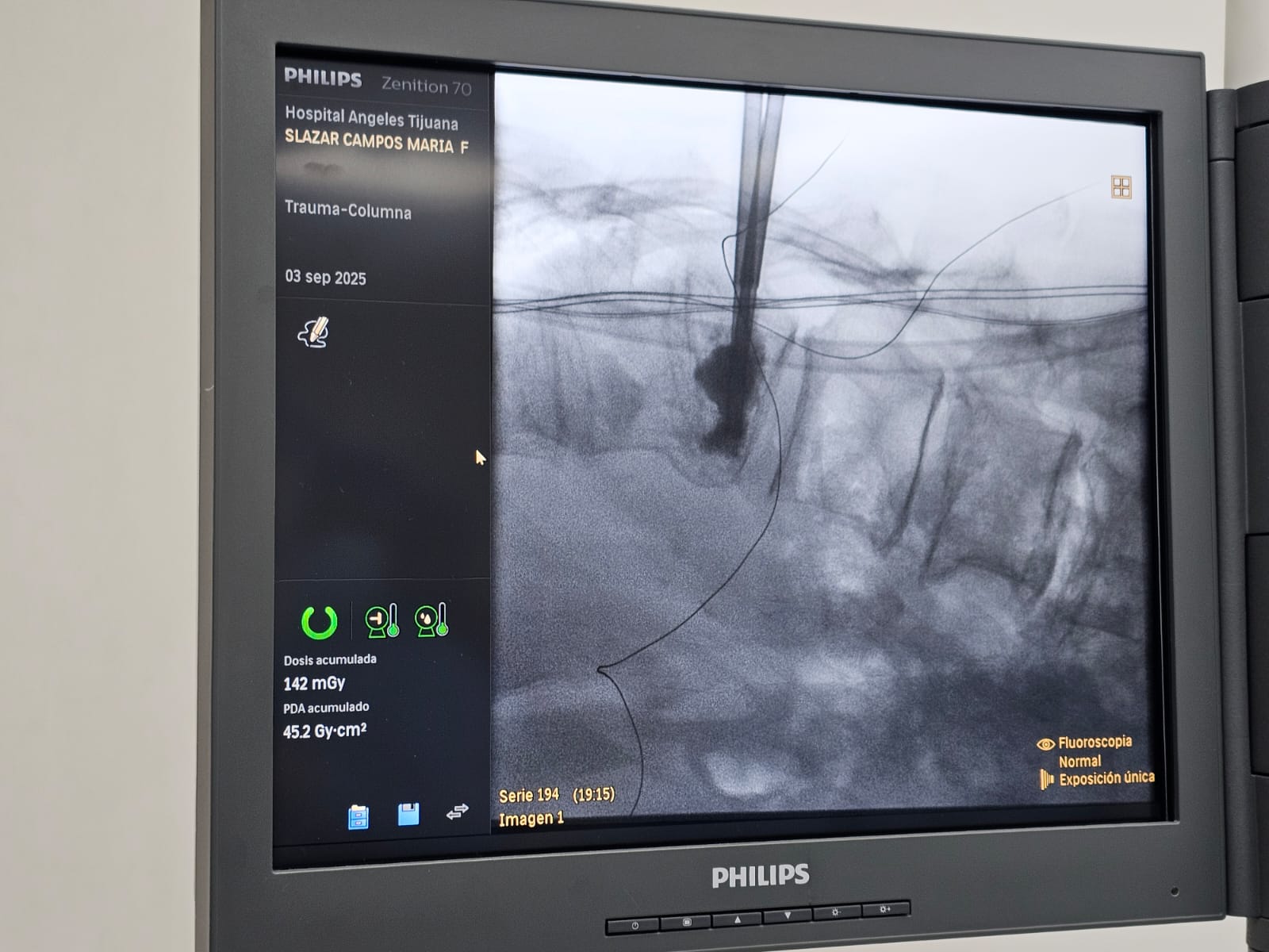 Ejemplo de Imagen Aqui