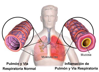 Ejemplo de Imagen informativa 3