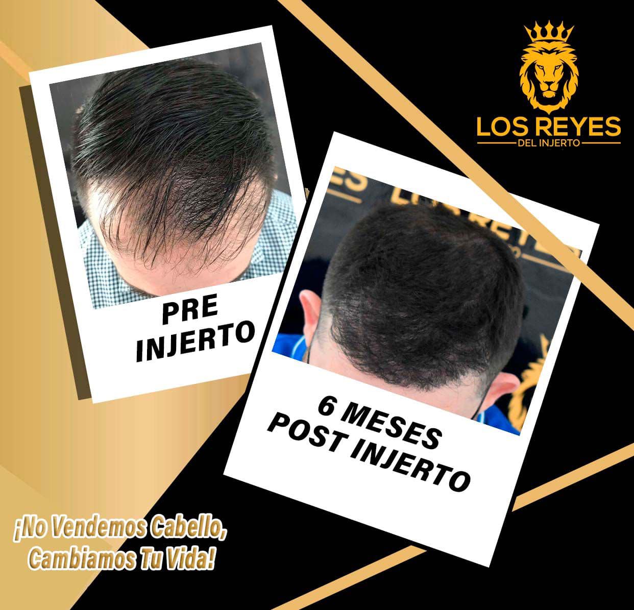Ejemplo de Imagen informativa 3